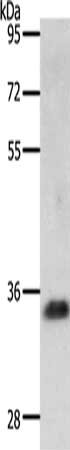 Gel: 10%SDS-PAGE, Lysate: 40 μg, Lane: Jurkat cells, Primary antibody: JUND Antibody(JUND Antibody) at dilution 1/800, Secondary antibody: Goat anti rabbit IgG at 1/8000 dilution, Exposure time: 2 minutes