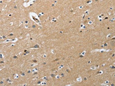 The image on the left is immunohistochemistry of paraffin-embedded Human brain  tissue using PIP5K1C Antibody(PIP5K1C Antibody) at dilution 1/25, on the right is treated with synthetic peptide. (Original magnification: ×200)Rabbit anti-Human PIP5K1C Polyclonal Antibody