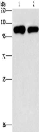 Gel: 10%SDS-PAGE, Lysate: 40 μg, Lane 1-2: A431 cells, hela cells, Primary antibody: PIP5K1C Antibody(PIP5K1C Antibody) at dilution 1/500, Secondary antibody: Goat anti rabbit IgG at 1/8000 dilution, Exposure time: 2 minutesRabbit anti-Human PIP5K1C Polyclonal Antibody