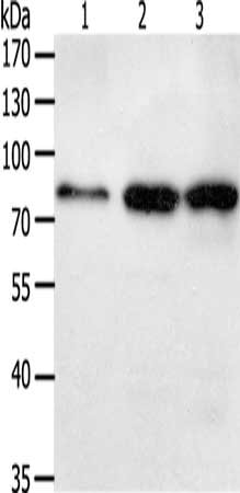 Gel: 10%SDS-PAGE, Lysate: 50 μg, Lane 1-3: Lovo cells, hela cells, human liver cancer tissue, Primary antibody: TGM2 Antibody(TGM2 Antibody) at dilution 1/150, Secondary antibody: Goat anti rabbit IgG at 1/8000 dilution, Exposure time: 1 minuteRabbit anti-Human TGM2 Polyclonal Antibody