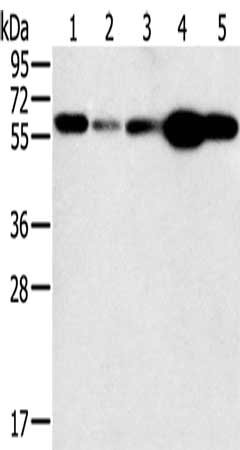 Gel: 10%SDS-PAGE, Lysate: 40 μg, Lane 1-5: Hela cells, Jurkat cells, mouse lung tissue, PC3 cells, mouse liver tissue, Primary antibody: PTGER2 Antibody(PTGER2 Antibody) at dilution 1/200, Secondary antibody: Goat anti rabbit IgG at 1/8000 dilution, Exposure time: 30 secondsRabbit anti-Human PTGER2 Polyclonal Antibody