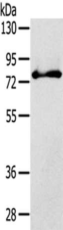 Gel: 8%SDS-PAGE,Lysate: 40 μg,,Primary antibody: SH3KBP1 Antibody(SH3KBP1 Antibody) at dilution 1/800 dilution,Secondary antibody: Goat anti rabbit IgG at 1/8000 dilution,Exposure time: 30 secondsRabbit anti-Human SH3KBP1 Polyclonal Antibody