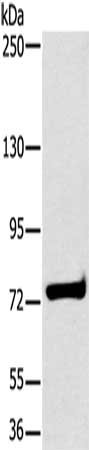 Gel: 6%SDS-PAGE, Lysate: 40 μg, Lane: K562 cells, Primary antibody: HSD17B4 Antibody(HSD17B4 Antibody) at dilution 1/400, Secondary antibody: Goat anti rabbit IgG at 1/8000 dilution, Exposure time: 10 secondsRabbit anti-Human HSD17B4 Polyclonal Antibody