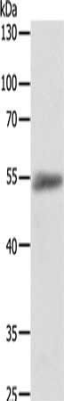 Gel: 10%SDS-PAGE, Lysate: 40 μg, Lane: Jurkat cells, Primary antibody: ODC1 Antibody(ODC1 Antibody) at dilution 1/400, Secondary antibody: Goat anti rabbit IgG at 1/8000 dilution, Exposure time: 1 minuteRabbit anti-Human ODC1 Polyclonal Antibody