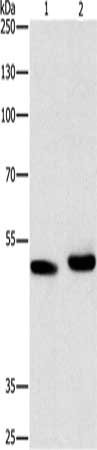 Gel: 10%SDS-PAGE, Lysate: 40 μg, Lane 1-2: 231 cells, human liver cancer tissue, Primary antibody: ATG4A Antibody(ATG4A Antibody) at dilution 1/300, Secondary antibody: Goat anti rabbit IgG at 1/8000 dilution, Exposure time: 10 minutes
