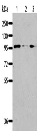 Gel: 8%SDS-PAGE, Lysate: 40 μg, Lane 1-3: Jurkat cells, 293T cells, K562 cells, Primary antibody: AKAP8L Antibody(AKAP8L Antibody) at dilution 1/117, Secondary antibody: Goat anti rabbit IgG at 1/8000 dilution, Exposure time: 30 secondsRabbit anti-Human AKAP8L Polyclonal Antibody