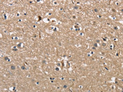 The image on the left is immunohistochemistry of paraffin-embedded Human brain  tissue using PGK1 Antibody(PGK1 Antibody) at dilution 1/40, on the right is treated with fusion protein. (Original magnification: X200)Rabbit anti-Human PGK1 Polyclonal Antibody