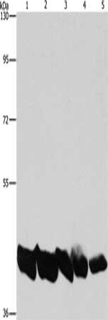 Gel: 10%SDS-PAGE, Lysate: 40 μg, Lane 1-5: A549 cells, hela cells, mouse liver tissue, human liver tissue, hepG2 cells, Primary antibody: PGK1 Antibody(PGK1 Antibody) at dilution 1/850, Secondary antibody: Goat anti rabbit IgG at 1/8000 dilution, Exposure time: 20 secondsRabbit anti-Human PGK1 Polyclonal Antibody