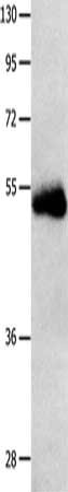 Gel: 10%SDS-PAGE, Lysate: 40 μg, Lane: Human seminoma tissue, Primary antibody: SLC2A1 Antibody(SLC2A1 Antibody) at dilution 1/650, Secondary antibody: Goat anti rabbit IgG at 1/8000 dilution, Exposure time: 10 minutesRabbit anti-Human SLC2A1 Polyclonal Antibody