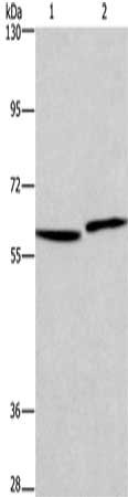 Gel: 6%SDS-PAGE, Lysate: 40 μg, Lane 1-2: Human testis tissue, Human prostate tissue, Primary antibody: HAS1 Antibody(HAS1 Antibody) at dilution 1/350, Secondary antibody: Goat anti rabbit IgG at 1/8000 dilution, Exposure time: 30 secondsRabbit anti-Human HAS1 Polyclonal Antibody