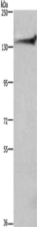 Gel: 6%SDS-PAGE, Lysate: 40 μg, Lane: 293T cells, Primary antibody: DCTN1 Antibody(DCTN1 Antibody) at dilution 1/200, Secondary antibody: Goat anti rabbit IgG at 1/8000 dilution, Exposure time: 10 secondsRabbit anti-Human DCTN1 Polyclonal Antibody
