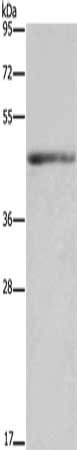 Gel: 8%SDS-PAGE, Lysate: 40 μg, Lane: Mouse heart tissue, Primary antibody: IL5RA Antibody(IL5RA Antibody) at dilution 1/650, Secondary antibody: Goat anti rabbit IgG at 1/8000 dilution, Exposure time: 3 minutesRabbit anti-Human IL5RA Polyclonal Antibody