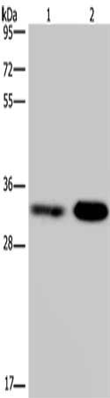 Gel: 10%SDS-PAGE, Lysate: 40 μg, Lane 1-2: Jurkat cells, NIH/3T3 cells, Primary antibody: CDK5 Antibody(CDK5 Antibody) at dilution 1/300, Secondary antibody: Goat anti rabbit IgG at 1/8000 dilution, Exposure time: 1 minuteRabbit anti-Human CDK5 Polyclonal Antibody