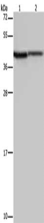 Gel: 10%SDS-PAGE, Lysate: 40 μg, Lane 1-2: A549 cells, mouse liver tissue, Primary antibody: P2RY1 Antibody(P2RY1 Antibody) at dilution 1/200, Secondary antibody: Goat anti rabbit IgG at 1/8000 dilution, Exposure time: 30 secondsRabbit anti-Human P2RY1 Polyclonal Antibody