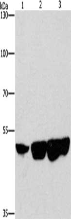 Gel: 8%SDS-PAGE, Lysate: 40 μg, Lane 1-3: Hela cells, hepG2 cells, 231 cells, Primary antibody: CTBP2 Antibody(CTBP2 Antibody) at dilution 1/400, Secondary antibody: Goat anti rabbit IgG at 1/8000 dilution, Exposure time: 3 minutesRabbit anti-Human CTBP2 Polyclonal Antibody