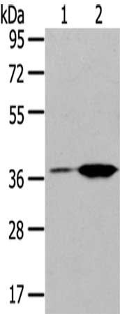 Gel: 8%SDS-PAGE,Lysate: 40 μg,Lane 1-2: Raji cells, Jurkat cells,Primary antibody: TBXA2R Antibody(TBXA2R Antibody) at dilution 1/200 dilution,Secondary antibody: Goat anti rabbit IgG at 1/8000 dilution,Exposure time: 40 secondsRabbit anti-Human TBXA2R Polyclonal Antibody