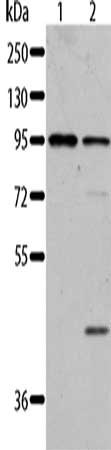 Gel: 8%SDS-PAGE, Lysate: 40 μg, Lane 1-2: Jurkat cells, 293T cells, Primary antibody: AKAP8L Antibody(AKAP8L Antibody) at dilution 1/84, Secondary antibody: Goat anti rabbit IgG at 1/8000 dilution, Exposure time: 20 secondsRabbit anti-Human AKAP8L Polyclonal Antibody