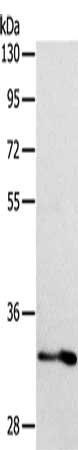 Gel: 10%SDS-PAGE, Lysate: 40 μg, Lane: Human fetal intestine tissue, Primary antibody: IL1RL1 Antibody(IL1RL1 Antibody) at dilution 1/700, Secondary antibody: Goat anti rabbit IgG at 1/8000 dilution, Exposure time: 2 minutesRabbit anti-Human IL1RL1 Polyclonal Antibody