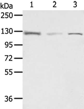 Gel: 6%SDS-PAGE, Lysate: 40 μg, Lane 1-3: 231, Jurkat and PC3 cell, Primary antibody: UBA1 Antibody(UBA1 Antibody) at dilution 1/600 dilution, Secondary antibody: Goat anti rabbit IgG at 1/8000 dilution, Exposure time: 3 minutesRabbit anti-Human UBA1 Polyclonal Antibody