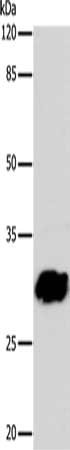 Gel: 10%SDS-PAGE, Lysate: 24 μg, Lane: 293T cells, Primary antibody: GJB6 Antibody(GJB6 Antibody) at dilution 1/1040, Secondary antibody: Goat anti rabbit IgG at 1/8000 dilution, Exposure time: 2 minutesRabbit anti-Human GJB6 Polyclonal Antibody