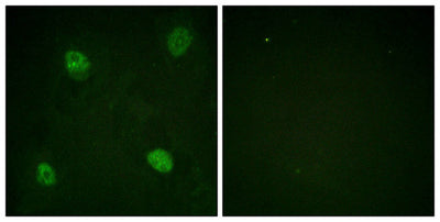 Immunofluorescence staining of methanol-fixed HeLa cells using hnRPD (Phospho-Ser83) Antibody.Rabbit anti-Human HNRNPD Polyclonal Antibody