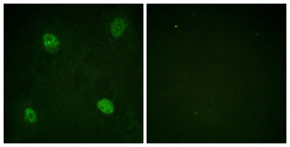 Immunofluorescence staining of methanol-fixed HeLa cells using hnRPD (Phospho-Ser83) Antibody.Rabbit anti-Human HNRNPD Polyclonal Antibody