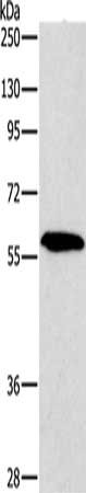 Gel: 10%SDS-PAGE, Lysate: 20 μg, Lane: A172 cells, Primary antibody: PAK2 Antibody(PAK2 Antibody) at dilution 1/400, Secondary antibody: Goat anti rabbit IgG at 1/8000 dilution, Exposure time: 5 minutesRabbit anti-Human PAK2 Polyclonal Antibody