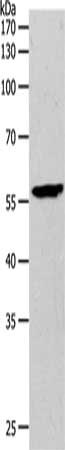 Gel: 10%SDS-PAGE, Lysate: 80 μg, Lane: Mouse brain tissue, Primary antibody: MMP27 Antibody(MMP27 Antibody) at dilution 1/500, Secondary antibody: Goat anti rabbit IgG at 1/8000 dilution, Exposure time: 2 minutesRabbit anti-Human MMP27 Polyclonal Antibody