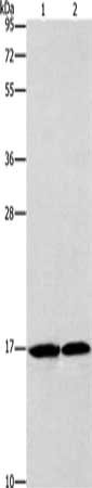 Gel: 10%SDS-PAGE, Lysate: 40 μg, Lane 1-2: Mouse heart tissue, human fetal brain tissue, Primary antibody: GMFG Antibody(GMFG Antibody) at dilution 1/1142, Secondary antibody: Goat anti rabbit IgG at 1/8000 dilution, Exposure time: 10 secondsRabbit anti-Human GMFG Polyclonal Antibody