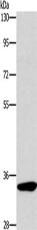Gel: 8%SDS-PAGE, Lysate: 40 μg, Lane: Mouse kidney tissue, Primary antibody: NCR1 Antibody(NCR1 Antibody) at dilution 1/450, Secondary antibody: Goat anti rabbit IgG at 1/8000 dilution, Exposure time: 1 minuteRabbit anti-Human NCR1 Polyclonal Antibody