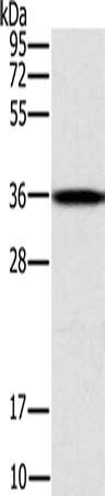 Gel: 10%SDS-PAGE, Lysate: 40 μg, Lane: Jurkat cells, Primary antibody: CENPV Antibody(CENPV Antibody) at dilution 1/200, Secondary antibody: Goat anti rabbit IgG at 1/8000 dilution, Exposure time: 1 secondRabbit anti-Human CENPV Polyclonal Antibody