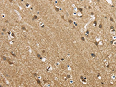 The image is immunohistochemistry of paraffin-embedded Human brain  tissue using GAS7 Antibody(GAS7 Antibody) at dilution 1/50. (Original magnification: ×200)Rabbit anti-Human GAS7 Polyclonal Antibody