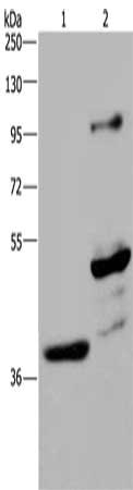 Gel: 8%SDS-PAGE, Lysate: 40 μg, Lane 1-2: Human fetal brain tissue, mouse brain tissue, Primary antibody: GAS7 Antibody(GAS7 Antibody) at dilution 1/625, Secondary antibody: Goat anti rabbit IgG at 1/8000 dilution, Exposure time: 2 minutesRabbit anti-Human GAS7 Polyclonal Antibody