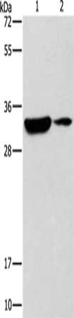 Gel: 12%SDS-PAGE, Lysate: 40 μg, Lane 1-2: Mouse heart tissue, Mouse brain tissue, Primary antibody: RCAN1 Antibody(RCAN1 Antibody) at dilution 1/500, Secondary antibody: Goat anti rabbit IgG at 1/8000 dilution, Exposure time: 1 minuteRabbit anti-Human RCAN1 Polyclonal Antibody
