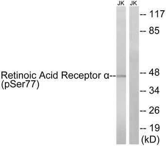 Western blot analysis of extracts from Jurkat cells treated with PMA (125ng/ml, 30mins), using Retinoic Acid Receptor α(Phospho-Ser77) antibody. The lane on the right is treated with the synthesized peptide.Rabbit anti-Human RARA Polyclonal Antibody