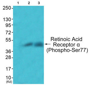 Western blot analysis of extracts from JK cells (Lane 2) and COS7 cells (Lane 3), using Retinoic Acid Receptor α (Phospho-Ser77) Antibody. The lane on the left is treated with synthesized peptide.Rabbit anti-Human RARA Polyclonal Antibody