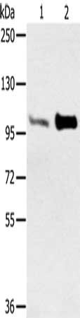 Gel: 6%SDS-PAGE, Lysate: 40μg, Lane 1-2: Mouse muscle tissue, Mouse heart tissue, Primary antibody: ACTN2 Antibody(ACTN2 Antibody) at dilution 1/300, Secondary antibody: Goat anti rabbit IgG at 1/8000 dilution, Exposure time: 20 secondsRabbit anti-Human ACTN2 Polyclonal Antibody