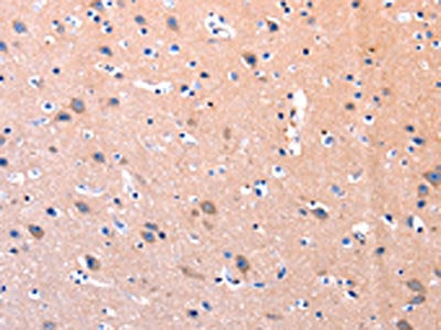 The image on the left is immunohistochemistry of paraffin-embedded Human brain tissue using the antibody Antibody) at dilution 1/75, on the right is treated with synthetic peptide. (Original magnification: ×200)