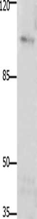 Gel: 8%SDS-PAGE, Lysate: 40 μg, Lane: Mouse brain tissue, Primary antibody: PTK2 Antibody(PTK2 Antibody) at dilution 1/1850, Secondary antibody: Goat anti rabbit IgG at 1/8000 dilution, Exposure time: 1 minute