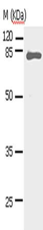 Gel: 10%SDS-PAGE, Lysate: 30 μg, Lane: Human fetal lung tissue, Primary antibody: STAT5A Antibody(STAT5A Antibody) at dilution 1/450, Secondary antibody: Goat anti rabbit IgG at 1/8000 dilution, Exposure time: 30 secondsRabbit anti-Human STAT5A Polyclonal Antibody