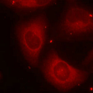 Immunofluorescence staining of methanol-fixed Hela cells using LIMK2(Phospho-Thr505) Antibody.