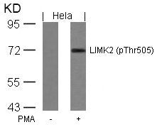 Western blot analysis of extracts from Hela cells untreated or treated with PMA using LIMK2(Phospho-Thr505) Antibody.