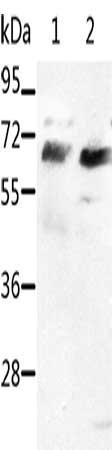 Gel: 10%SDS-PAGE, Lysate: 50 μg, Lane 1-2: HT29 cells, Jurkat cells, Primary antibody: SRF Antibody(SRF Antibody) at dilution 1/400, Secondary antibody: Goat anti rabbit IgG at 1/8000 dilution, Exposure time: 1 minuteRabbit anti-Human SRF Polyclonal Antibody