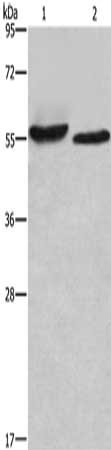 Gel: 6%SDS-PAGE, Lysate: 40 μg, Lane 1-2: SP20 cells, mouse heart tissue, Primary antibody: AMIGO2 Antibody(AMIGO2 Antibody) at dilution 1/615, Secondary antibody: Goat anti rabbit IgG at 1/8000 dilution, Exposure time: 2 minutesRabbit anti-Human AMIGO2 Polyclonal Antibody