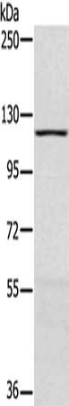 Gel: 6%SDS-PAGE, Lysate: 40 μg, Lane: Human fetal muscle tissue, Primary antibody: MAPK7 Antibody(MAPK7 Antibody) at dilution 1/250, Secondary antibody: Goat anti rabbit IgG at 1/8000 dilution, Exposure time: 40 seconds