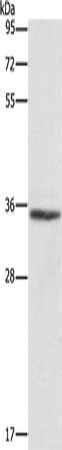 Gel: 10%SDS-PAGE, Lysate: 40 μg, Lane: Lovo cells, Primary antibody: ANXA3 Antibody(ANXA3 Antibody) at dilution 1/500, Secondary antibody: Goat anti rabbit IgG at 1/8000 dilution, Exposure time: 3 secondsRabbit anti-Human ANXA3 Polyclonal Antibody