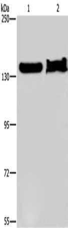 Gel: 6%SDS-PAGE, Lysate: 40 μg, Lane 1-2: NIH/3T3 cells, mouse liver tissue, Primary antibody: KDM4A Antibody(KDM4A Antibody) at dilution 1/650, Secondary antibody: Goat anti rabbit IgG at 1/8000 dilution, Exposure time: 5 minutes
