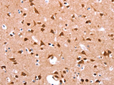 The image on the left is immunohistochemistry of paraffin-embedded Human brain  tissue using FUT8 Antibody(FUT8 Antibody) at dilution 1/20, on the right is treated with synthetic peptide. (Original magnification: ×200)Rabbit anti-Human FUT8 Polyclonal Antibody