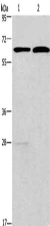Gel: 6%SDS-PAGE, Lysate: 40 μg, Lane 1-2: LoVo cells, PC3 cells, Primary antibody: FUT8 Antibody(FUT8 Antibody) at dilution 1/200, Secondary antibody: Goat anti rabbit IgG at 1/8000 dilution, Exposure time: 1 minuteRabbit anti-Human FUT8 Polyclonal Antibody