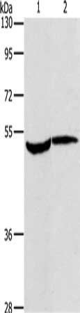 Gel: 8%SDS-PAGE, Lysate: 40 μg, Lane 1-2: Human chromaffin cell tumor tissue, A431 cells, Primary antibody: MAPKAPK2 Antibody(MAPKAPK2 Antibody) at dilution 1/350, Secondary antibody: Goat anti rabbit IgG at 1/8000 dilution, Exposure time: 6 minutes